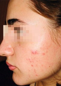 коллаген ботокс для волос