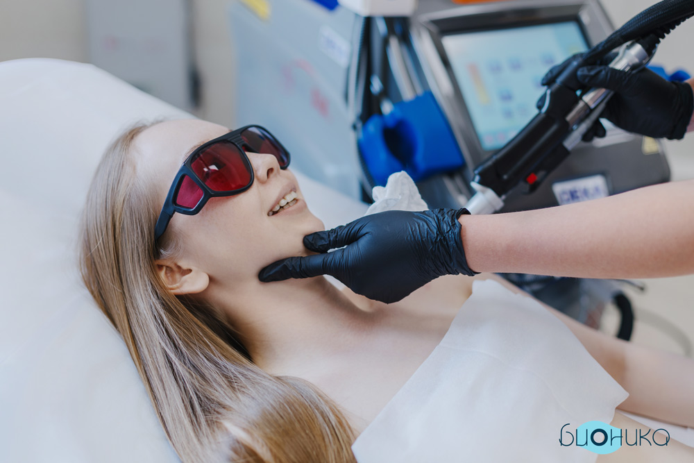 Лазерная эпиляция